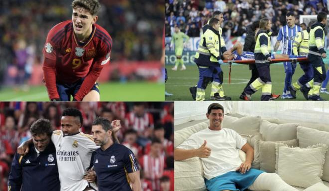 有咬合度 有咬合度